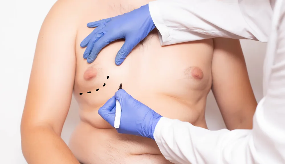 Cosmetic Surgeries 