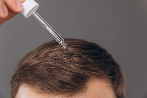 hair loss and mental health