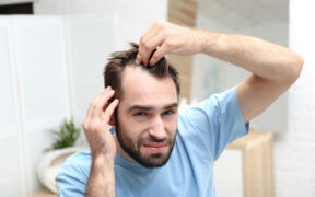 hair transplant Turkey